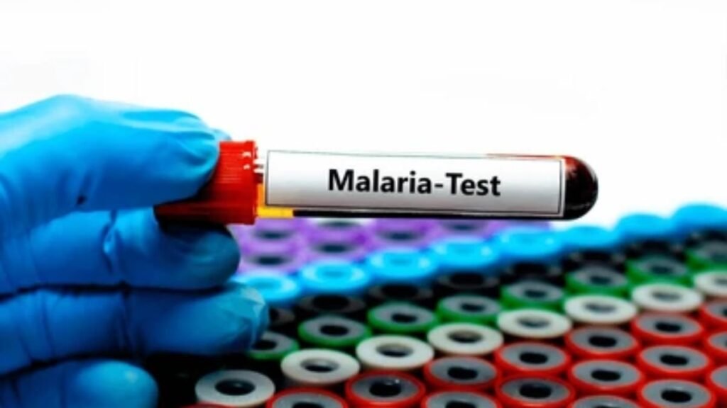 Epidemiología reporta 874 casos de malaria en el país y confirma que la mayoría son autóctonos